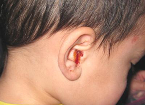 возможные причины крови из ушей