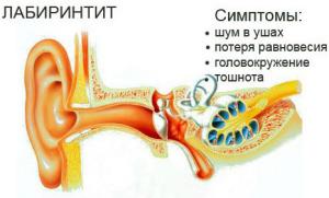 воспаление внутреннего уха симптомы