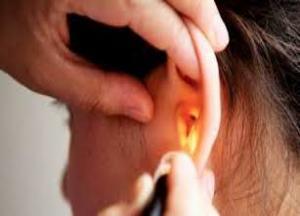 лечение отомикоза уха