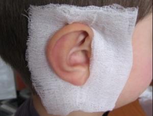 как наложить компресс на больное ухо ребенку
