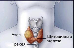 щитовидная железа симптомы заболевания у мужчин